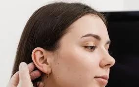 What happens during an Otoplasty procedure?